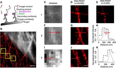 DNA-PAINT Imaging Accelerated by Machine Learning